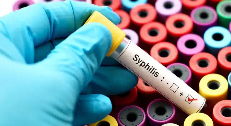 Aumentan casos de sífilis en el estado Aumentan casos de sífilis en el estado